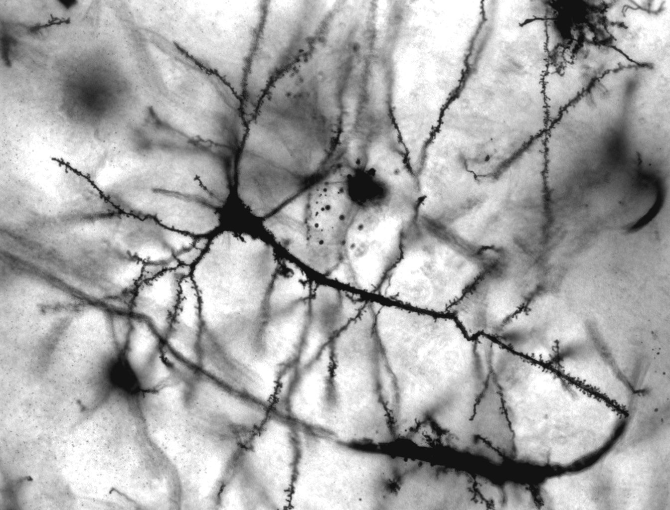 A Golgi-stained pyramidal neuron from the human hippocampus at 40x magnification: a dark cell body with spine-covered dendrites branching across the field.